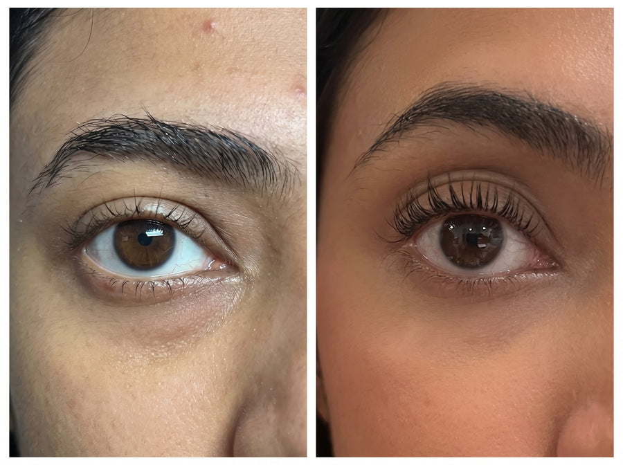Lashes after using the serum